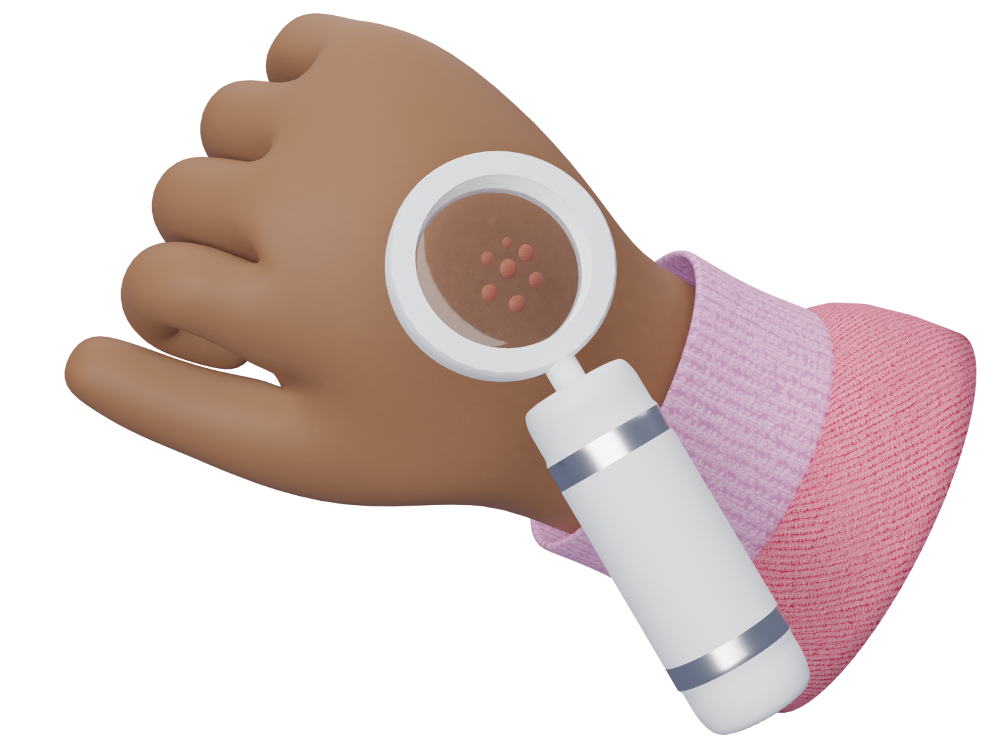 A hand with a rash is being looked at through a magnifying glass.