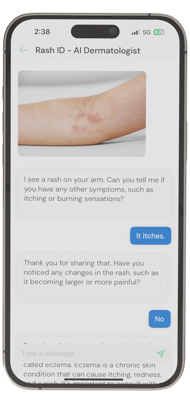 Rash ID's MUM, an interactive AI dermatologist asks questions to identify a skin disorder.