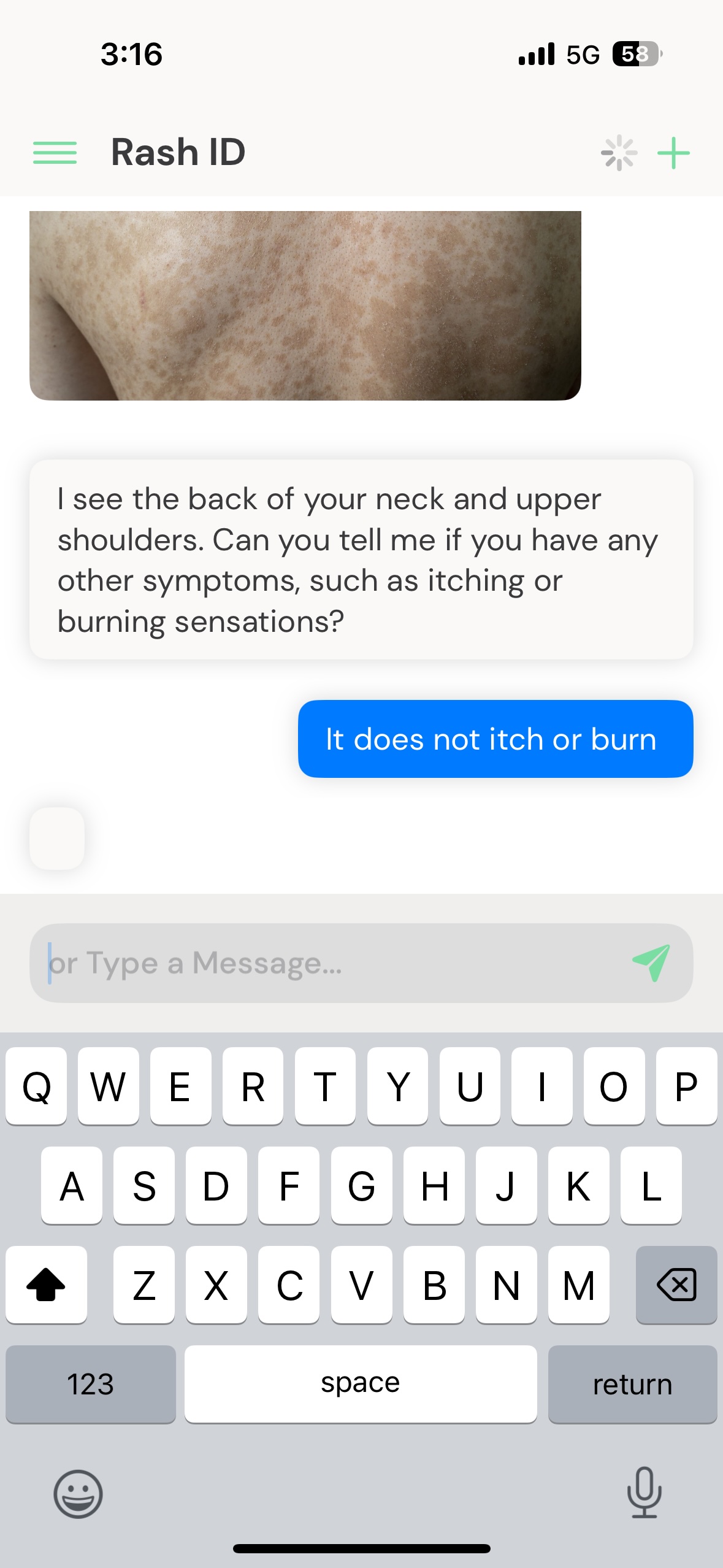 Rash ID asking doctor-style symptom questions about an uploaded photo