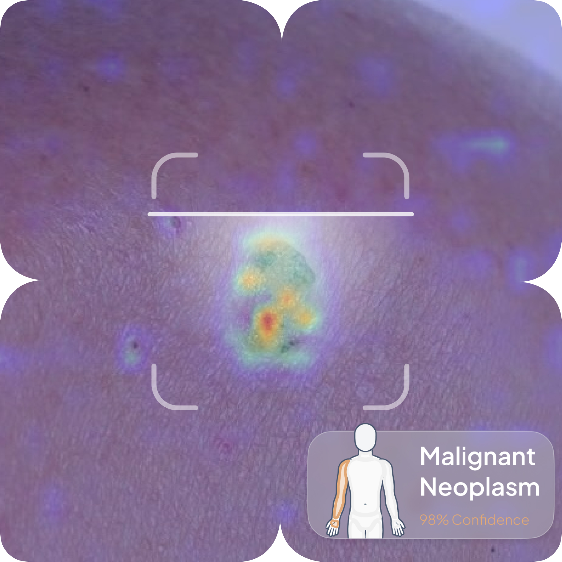 Analysis mobile screenshot